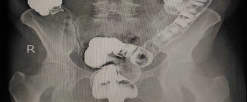 Image hover effect image