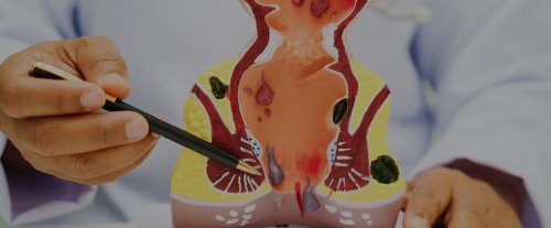 Image hover effect image