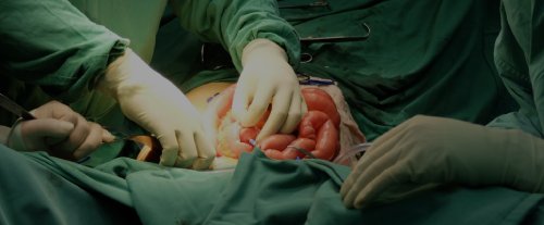 Image hover effect image